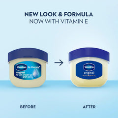Vaseline Lip Therapy 4 Twin Packs (8 Jars Total) – Mini Lip Balm for Healing Dry Lips, Travel-Size Petroleum Jelly Lip Care, 0.25 Oz Each