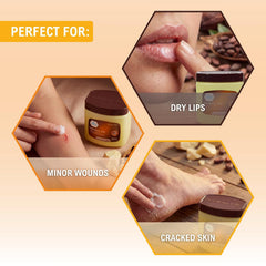 MED PRIDE Cocoa Butter Petroleum Jelly, 8 oz – Moisturizing Skin Protectant for Dry Skin, Cracked Hands, Rough Heels, Chapped Lips, Minor Cuts, Scrapes & Burns – Cocoa-Scented, Hypoallergenic Ointment