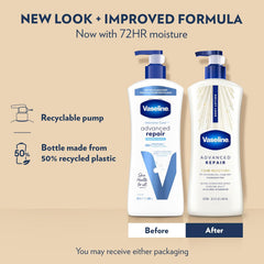 Vaseline Advanced Repair Body Lotion Advanced Repair Unscented for Dry Skin Lotion Made with Ultra-Hydrating Lipids and Vaseline Jelly That Repairs Extremely Dry Skin 20.3 Fl oz